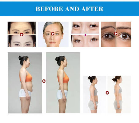 Multi Function 40KHZ EMS Face Lifting Beauty Machine